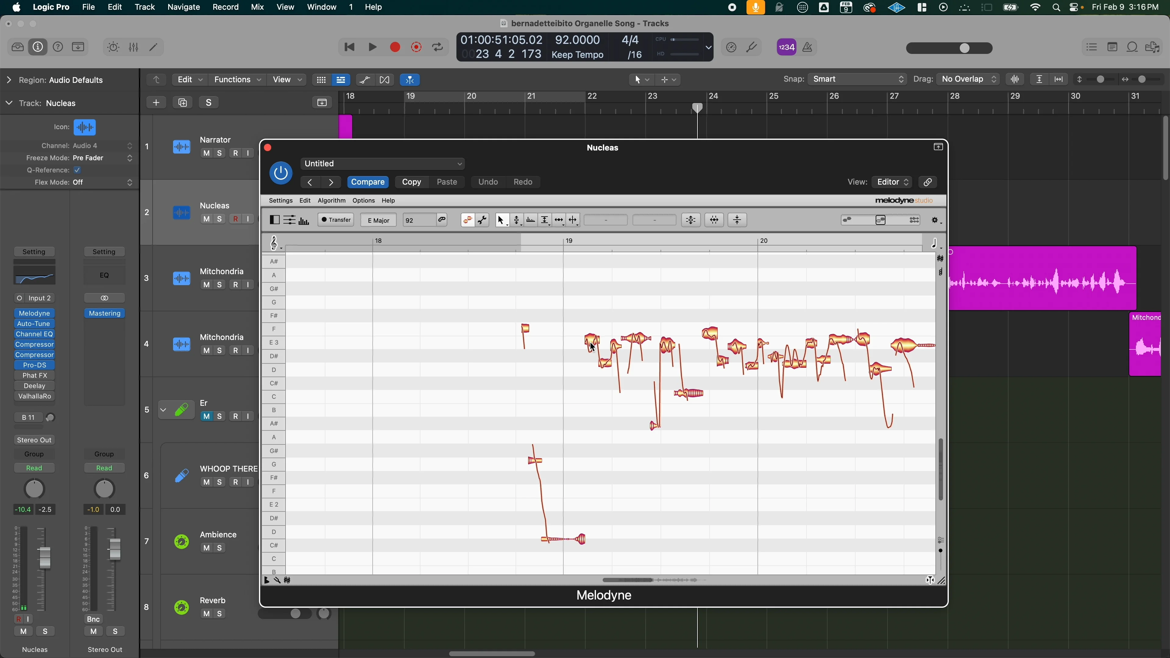 Logic Pro Melodyne pitch correction plugin showing AI-assisted vocal editing and note detection